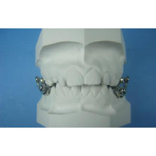 High Quality Dental Orthodontic Herbst Retainer